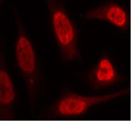 Rabbit Anti-p53 (Ab-15) Polyclonal Antibody IF