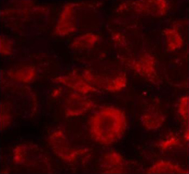 Rabbit Anti-HSP90B (Ab-254) Polyclonal Antibody IF