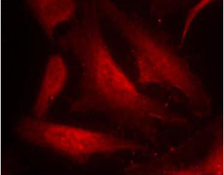 Rabbit Anti-cdc25C (Phospho-Ser216) Polyclonal Antibody IF Rabbit Anti-cdc25C (Phospho-Ser216) Polyclonal Antibody IF