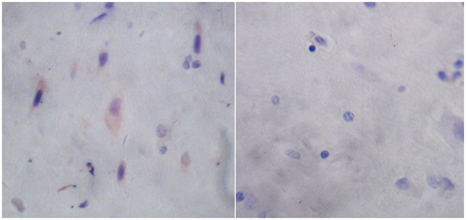 Rabbit Anti-DJ-1 Polyclonal Antibody IHC