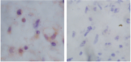 Rabbit Anti-Doublecortin Polyclonal Antibody IHC