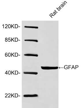 Rabbit Anti-GFAP Polyclonal Antibody