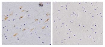 Rabbit Anti-GFAP Polyclonal Antibody