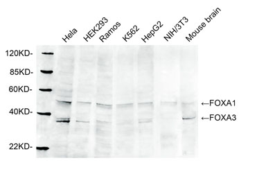 Rabbit Anti-FOXA1 Polyclonal Antibody