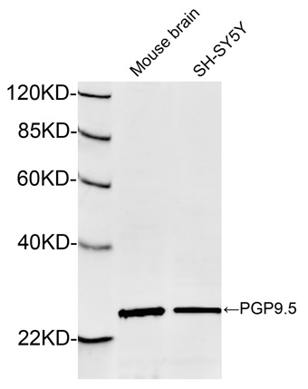 Rabbit Anti-PGP9.5 Polyclonal Antibody