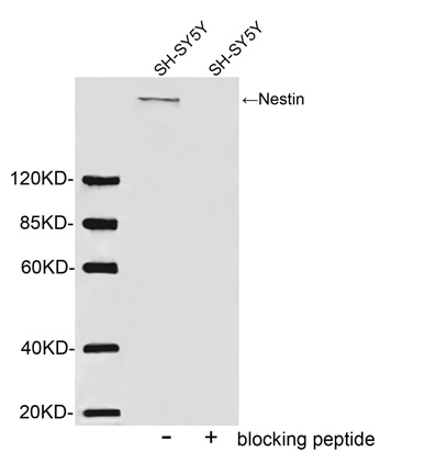 Rabbit Anti-Nestin Polyclonal Antibody