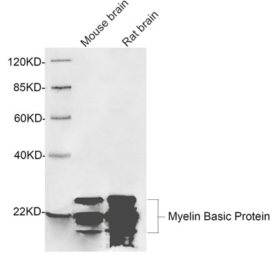 Rabbit Anti-Myelin Basic Protein Polyclonal Antibody