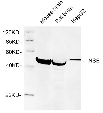 Rabbit Anti-NSE Polyclonal Antibody