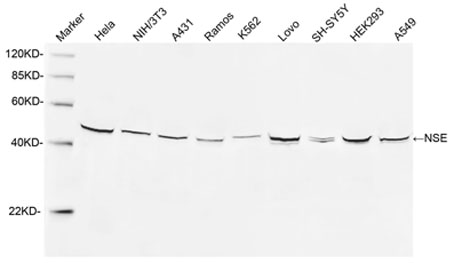 Rabbit Anti-NSE Polyclonal Antibody