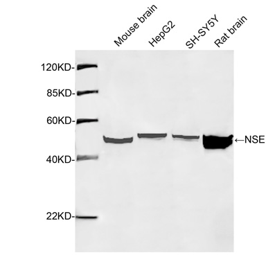 Rabbit Anti-NSE Polyclonal Antibody