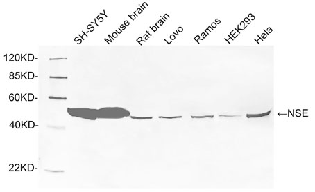 Rabbit Anti-NSE Polyclonal Antibody