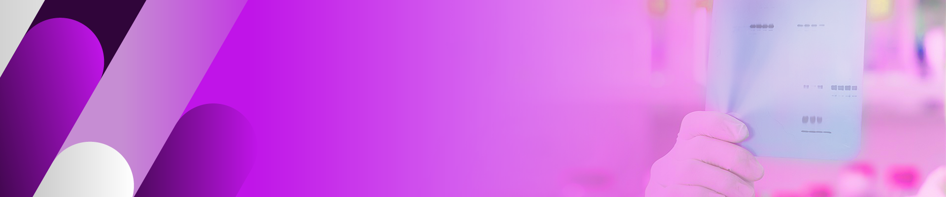 Protein Electrophoresis and Blotting