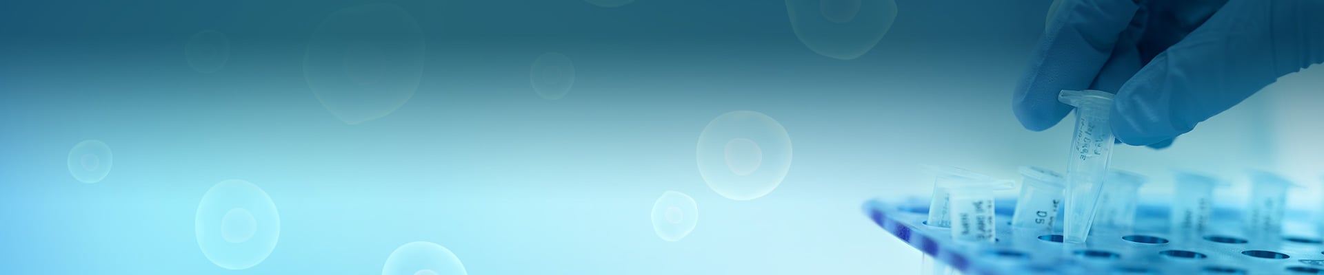 Plasmid Vectors