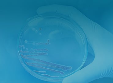 S. marcescens Nuclease