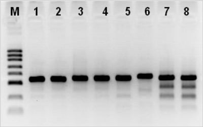  PCR products analysis by agarose gel
