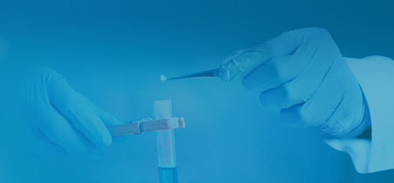 Endotoxin Detection