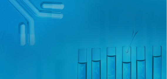 Protein Purification Resins