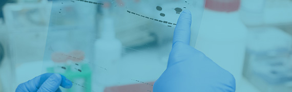 Protein Electrophoresis and Blotting