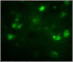 THE Elite Antibody THE Elite Antibody