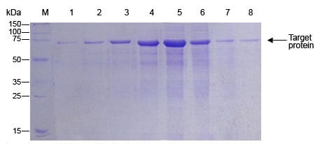 Baculovirus Expression System