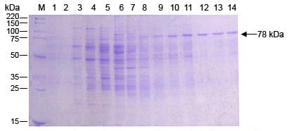 Baculovirus Protein Purification