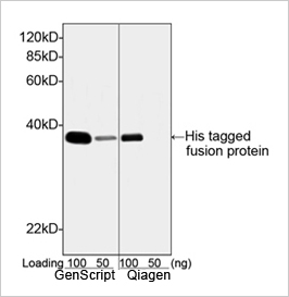 His tag Antibody His tag Antibody