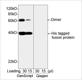 His Tag Antibody His Tag Antibody