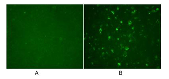 His Tag Antibody His Tag Antibody