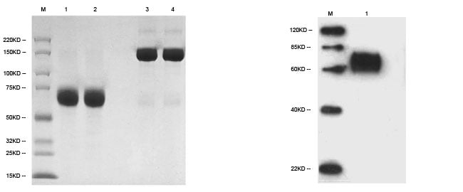 Recombinant Protein Expression