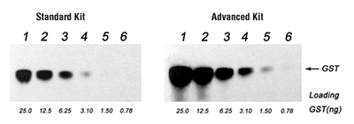 Western Advanced Kit Western Blotting Kit, western blot