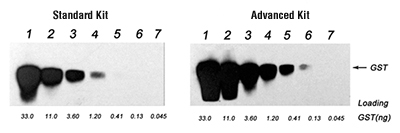 Western Advanced Kit Western Blotting Kit, western blot
