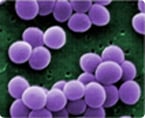 aureus virulence, immune evasion