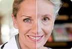 aging biomarker, 3D facial morphogenesis