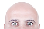 Baldness, Hair follicle regeneration, Tissue regeneration