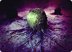 cancer, tumor metastasis