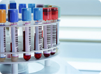Developing blood-based assays to detect cancer