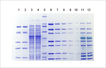 ExpressPlusâ„¢ PAGE Gels - precast gel; polyacrylamide gel; page gel; bis