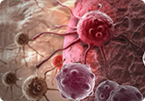 cancer, cancer evolution, malignant cancer, cancer development