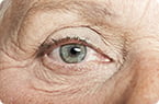 skin renewal