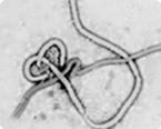 ebola virus, siRNA therapeutics