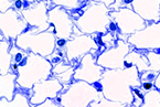 SIRT1, metabolic dysfunction