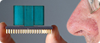 electronic nose, nanoparticle-based sensor, exhaled breath, volatile organic compounds, ovarian cancer