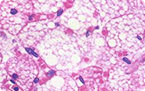 WAT browning, uncoupling protein 1, UCP1