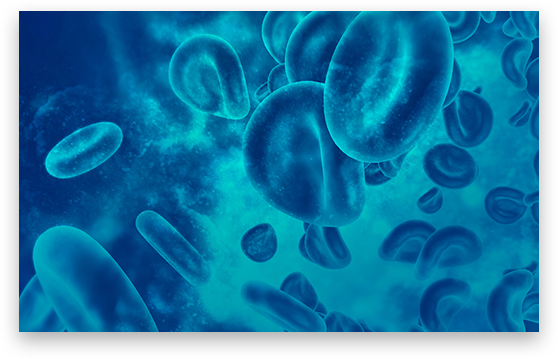 Hemoglobinopathies
