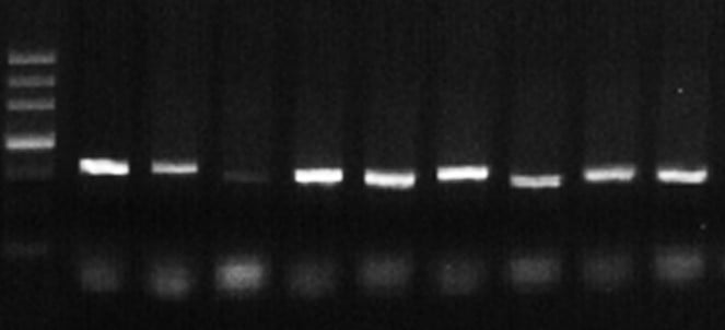 Fig. 2 Colony screening Fig. 2 Colony screening