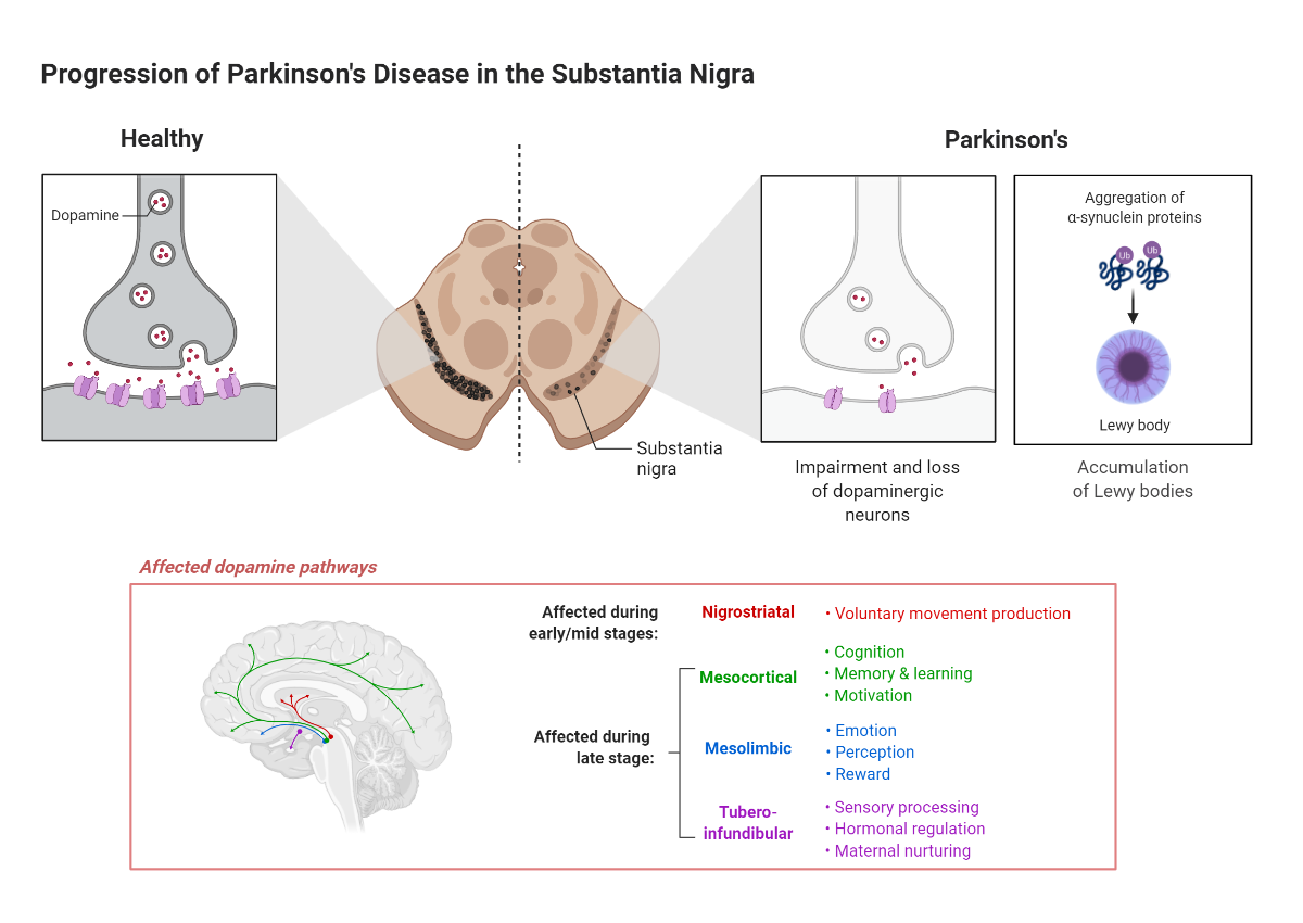α-Synuclein Aggregation in Treatment of Parkinson's Disease