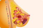 cells, stem cells, cancer dormancy, cell cannibalism, cancer recurrence