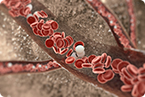CRISPR, sickle cell, hemoglobin