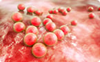 astrocytes, microglia, neurons, neurodegenerative diseases, alzheimers, reactive astrocytes, inflammatory responses