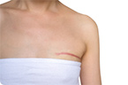 wound healing, skin regeneration, fibroblast